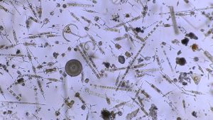 Photo-de-plancton-depuis-notre-microscope-curiosity