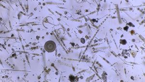 Photo-de-plancton-depuis-notre-microscope-curiosity (1)
